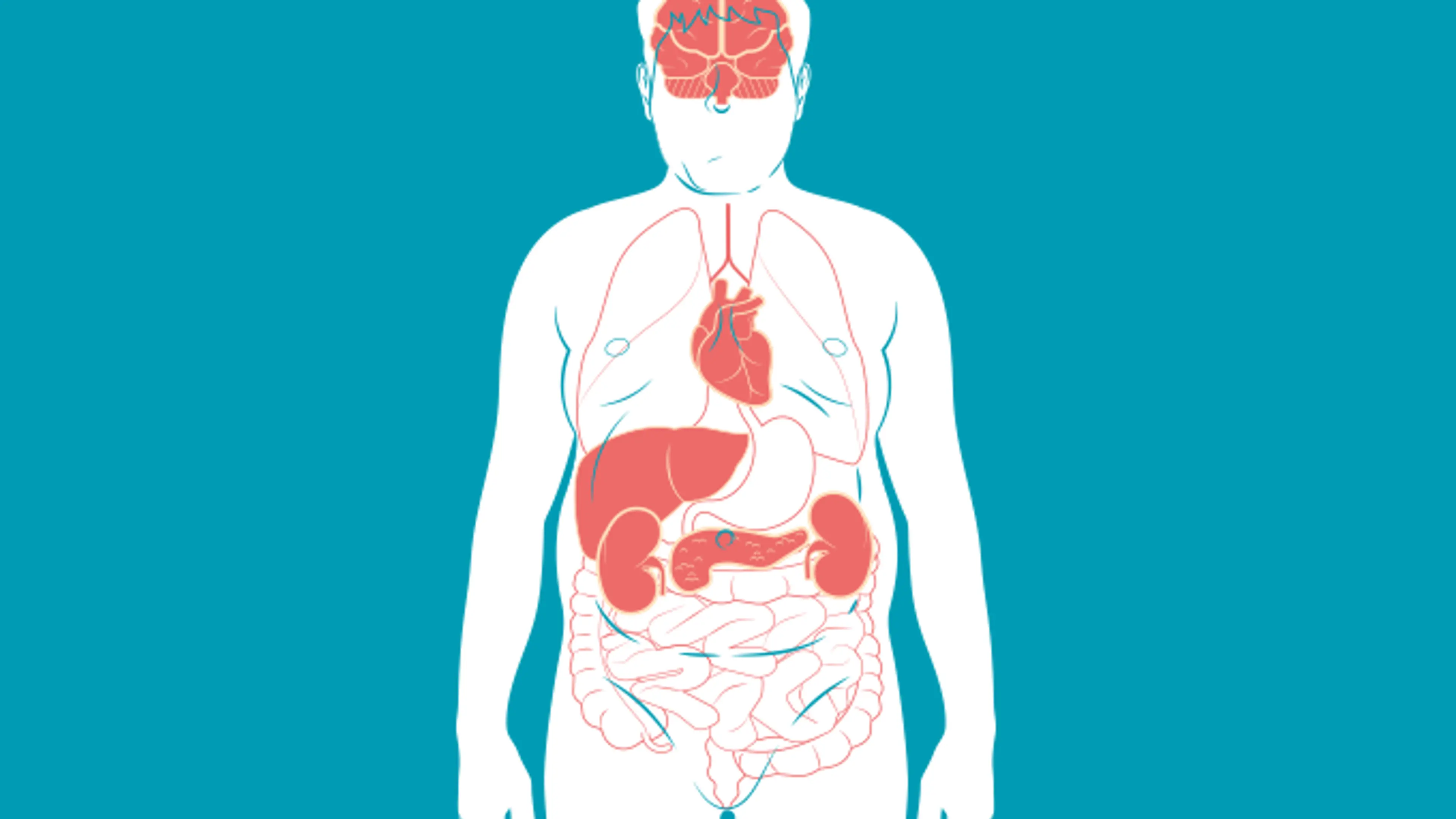 Afinal, o que é a Síndrome Metabólica?